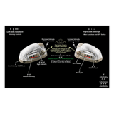 Lampe Trilobyte Base Helmet Light Adventure Lights